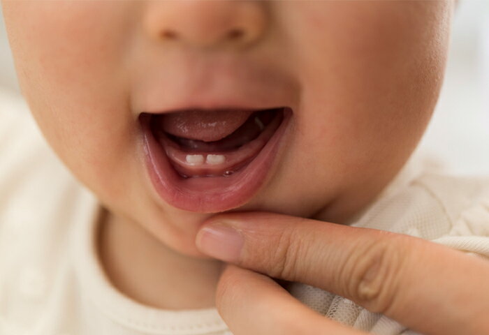乳歯の生え変わり時期はいつ？乳歯の虫歯などトラブルの対処法も解説！【歯科医監修】