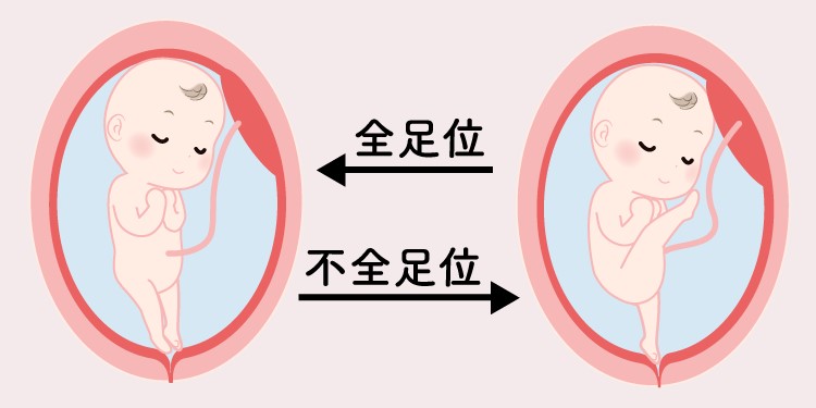 胎児胎向胎位: 胎位胎向 図 – TPWCKV