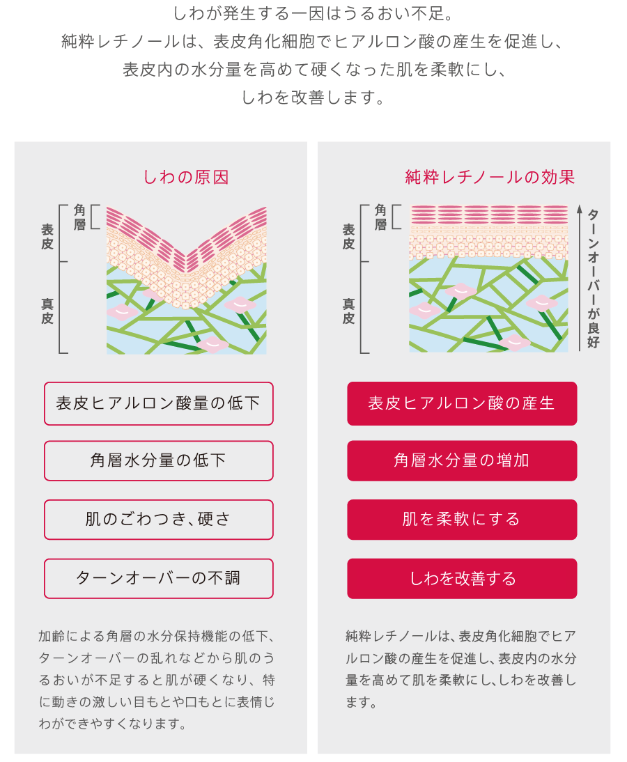 しわが発生する一因はうるおい不足。純粋レチノールは、表皮角化細胞でヒアルロン酸の産生を促進し、表皮内の水分量を高めて固くなった肌を柔軟にし、しわを改善します。