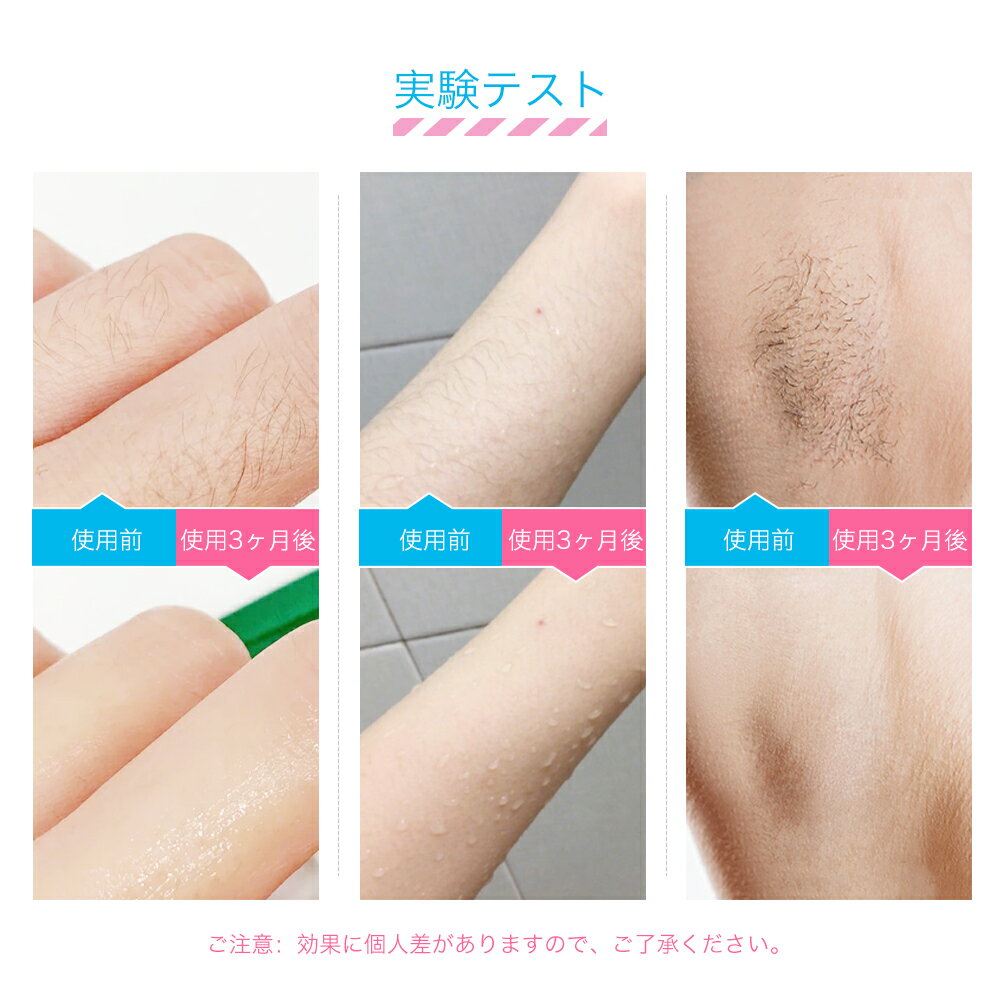 楽天市場】NEXT BEAUYT 家庭用冷感光脱毛器 NBD03 | 価格比較 - 商品