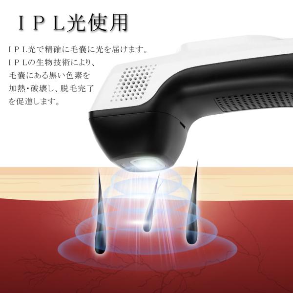 楽天市場】Entil IPL脱毛器 M2 | 価格比較 - 商品価格ナビ