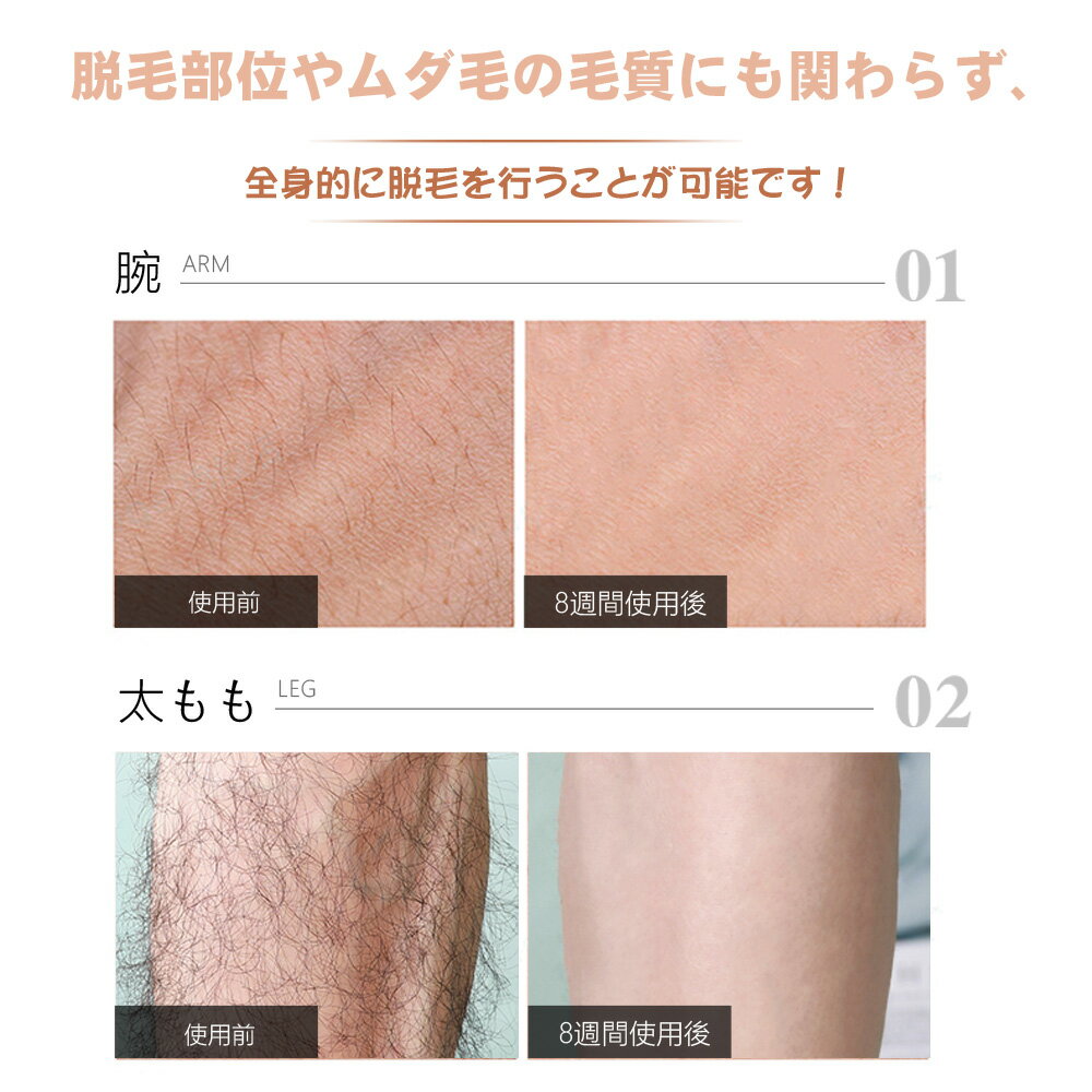 Sarlist IPL光脱毛器 ホワイト AI-01