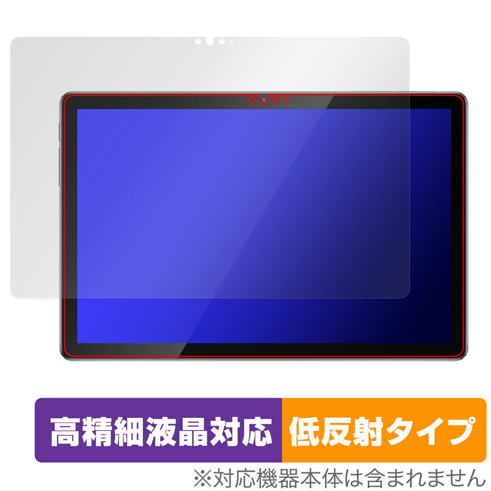 ミヤビックス OverLay Plus Lite for Blackview Tab 12 Pro OTBLACKVIEWTAB12PRO/1