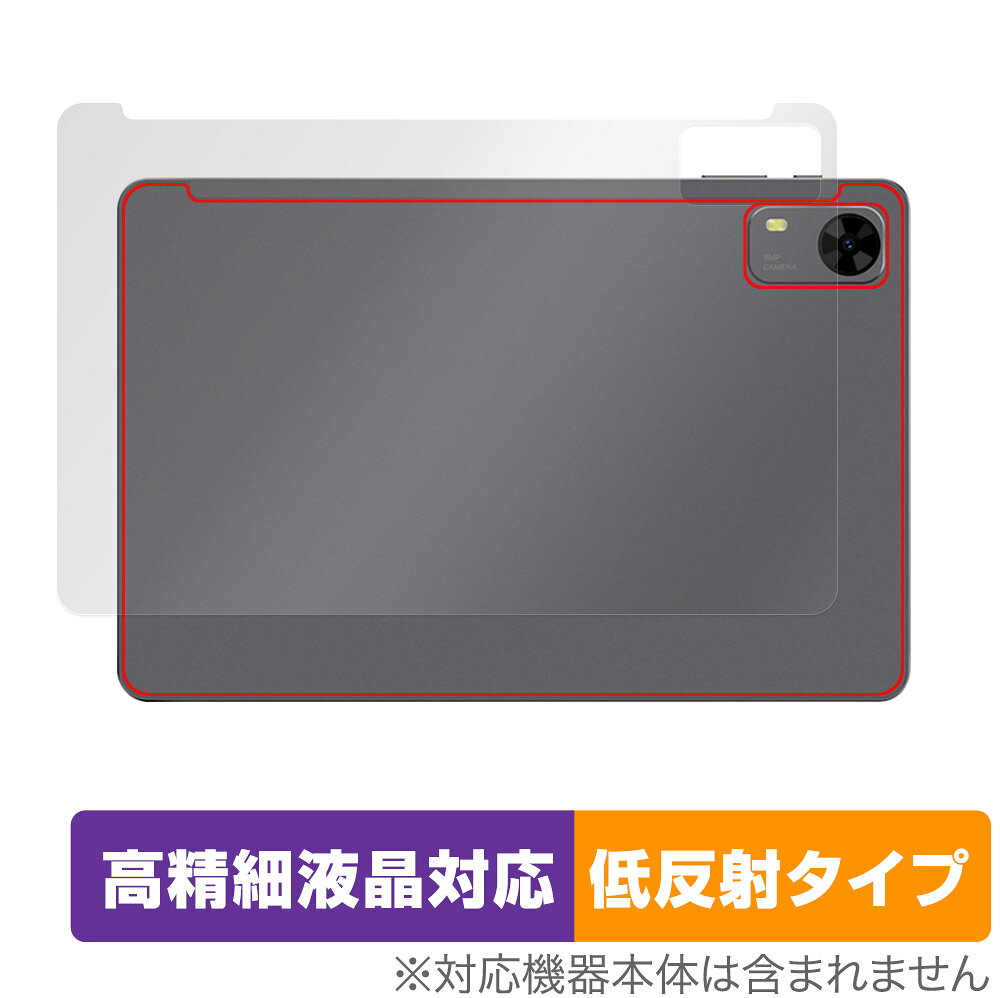 ミヤビックス OverLay Eye Protector 9H for PHILIPS T7315 表面用保護シート O9HEPHPT7315/F/2