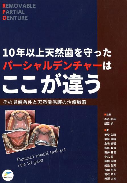 １０年以上天然歯を守ったパーシャルデンチャーはここが違う その具備条件と天然歯保護の治療戦略/インタ-アクション/寺西邦彦
