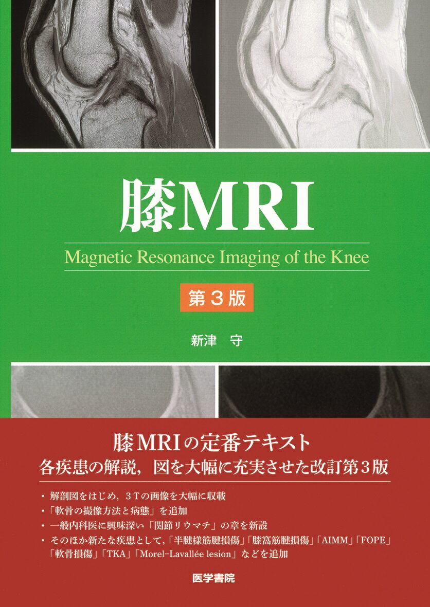 楽天市場】メジカルビュー社 肩関節のMRI 読影ポイントと