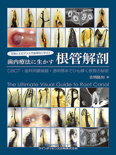 楽天市場】ビジュアル歯内療法学 生物学的コンセプトと