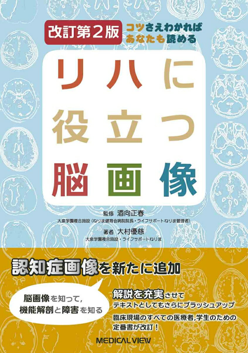リハに役立つ脳画像 コツさえわかればあなたも読める 改訂第２版/メジカルビュ-社/酒向正春