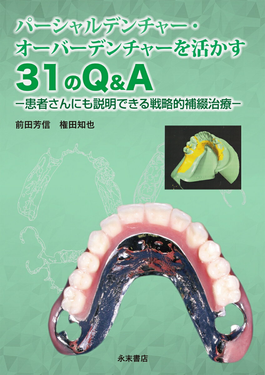 楽天市場】永末書店 埋伏歯の保存治療ストラテジー 誘導・牽引の