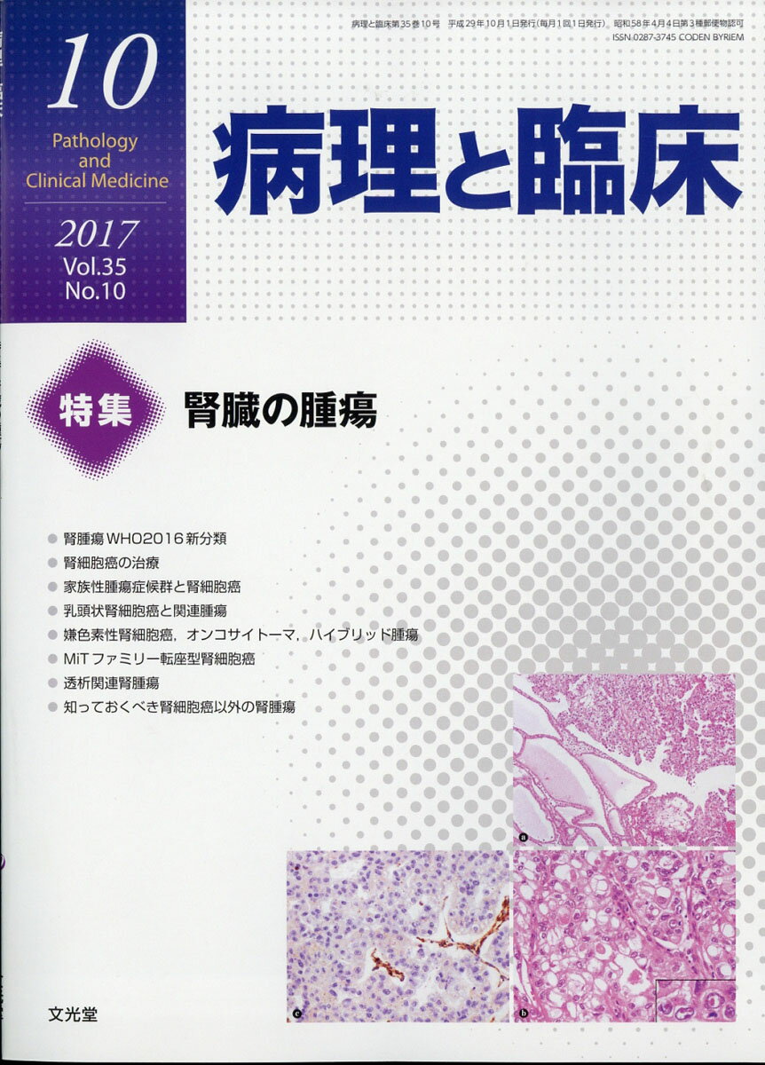癌の分子病理学 2016年 04 月号 [雑誌]: 病理と臨床 増刊 楽天市場】癌の分子病理学 2016年 04月号 [雑誌]/文光堂 | 価格