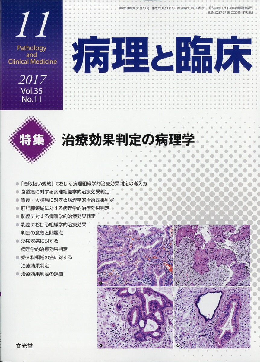楽天市場】癌の分子病理学 2016年 04月号 [雑誌]/文光堂 | 価格