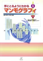 楽天市場】鍬谷書店 手にとるようにわかる健診のための眼底検査 無散瞳