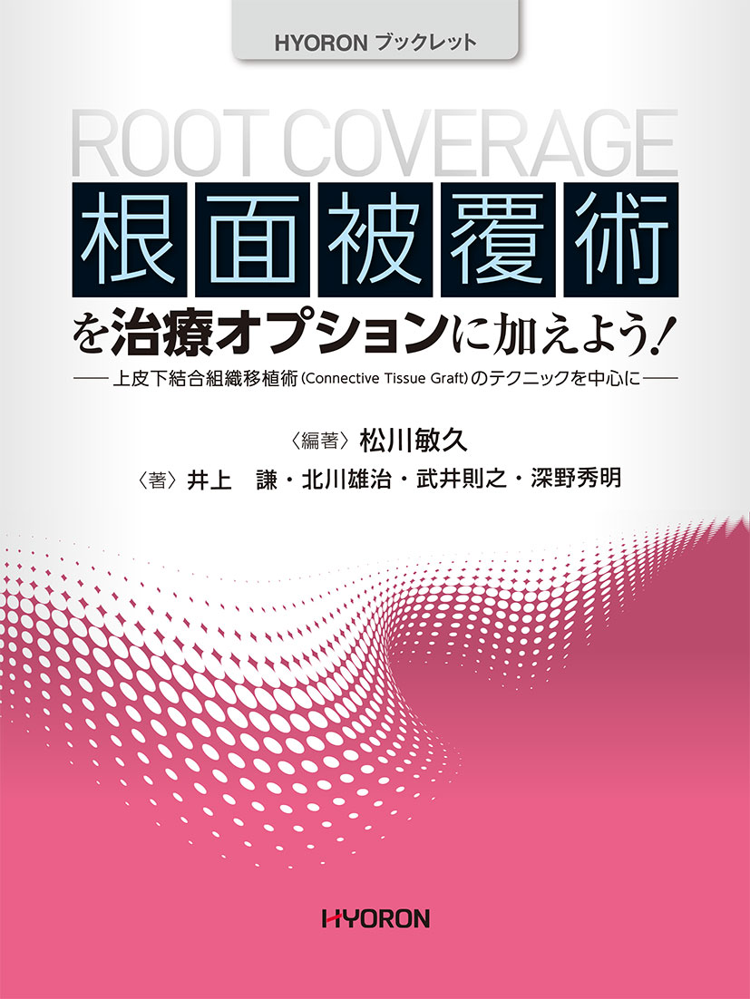 根面被覆術を治療オプションに加えよう！ 上皮下結合組織移植術のテクニックを中心に/ヒョ-ロン・パブリッシャ-ズ/松川敏久