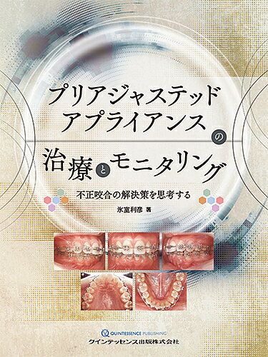 楽天市場】クインテッセンス出版 矯正治療の長期経過と保定管理 不正