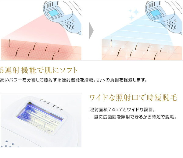 楽天市場】LA VIE LA VIE(ラヴィ) 家庭用IPL光脱毛器 LAVIE LVA500