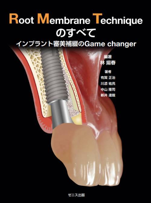 Root Membrane Technique のすべて 本/雑誌 インプラント審美補綴のGame changer / 林揚春/編 有賀正治/著 川添祐亮/著 中山隆司/著 新井達哉/著
