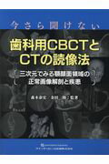 今さら聞けない歯科用ＣＢＣＴとＣＴの読像法 -三次元でみる顎顔面領域の正常画像解剖と疾患-/クインテッセンス出版/森本泰宏