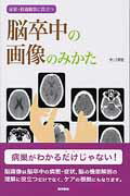 脳卒中の画像のみかた 症状・経過観察に役立つ/医学書院/市川博雄
