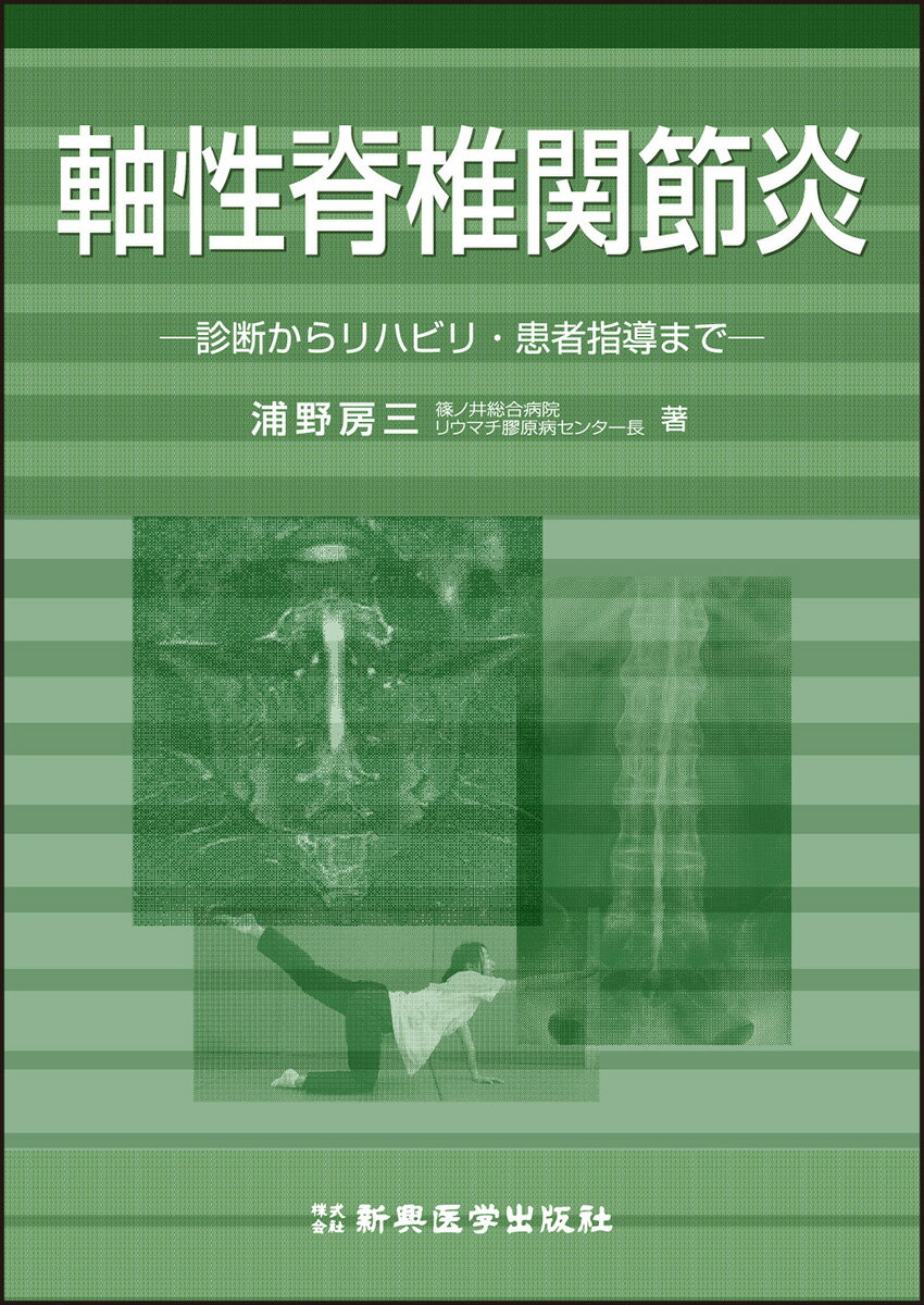 とにかく基礎から固める 脊椎の画像診断 とにかく基礎から固める 脊椎の画像診断 | 稲岡 努 |本 | 通販
