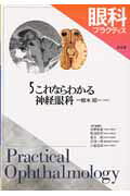 【中古】 イラスト眼科/文光堂/渡辺郁緒 イラスト眼科 (Bunkodo illustrated basic series) | 渡邊 郁緒