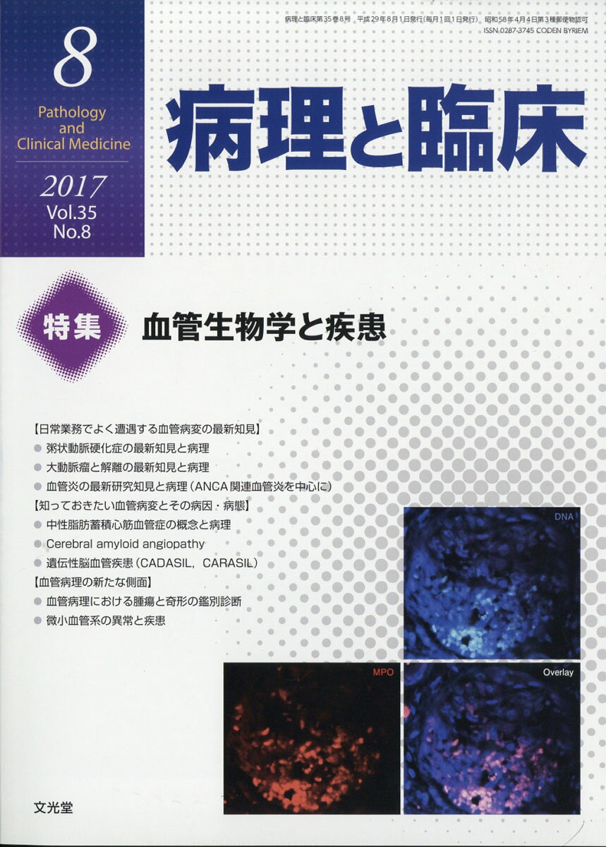 癌の分子病理学 2016年 04 月号 [雑誌]: 病理と臨床 増刊 楽天市場】癌の分子病理学 2016年 04月号 [雑誌]/文光堂 | 価格