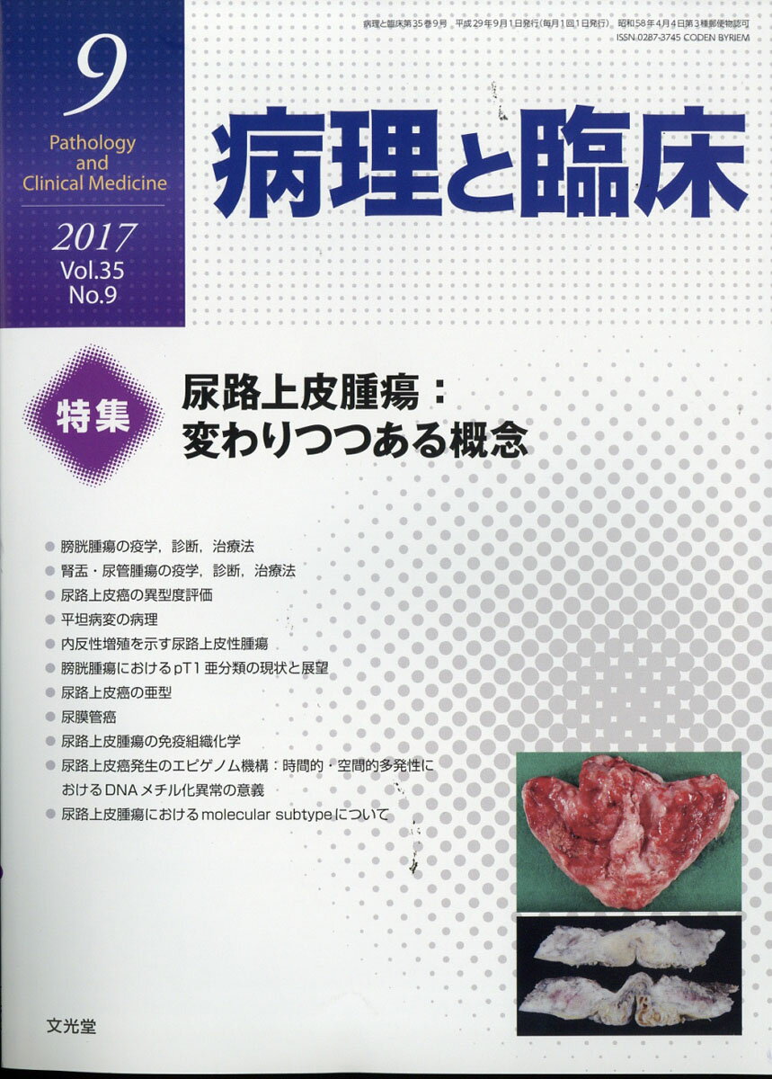 癌の分子病理学 2016年 04 月号 [雑誌]: 病理と臨床 増刊 楽天市場】癌の分子病理学 2016年 04月号 [雑誌]/文光堂 | 価格