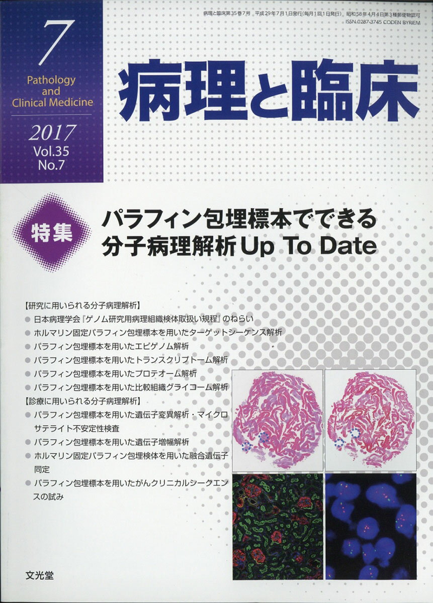 癌の分子病理学 2016年 04 月号 [雑誌]: 病理と臨床 増刊 楽天市場】癌の分子病理学 2016年 04月号 [雑誌]/文光堂 | 価格