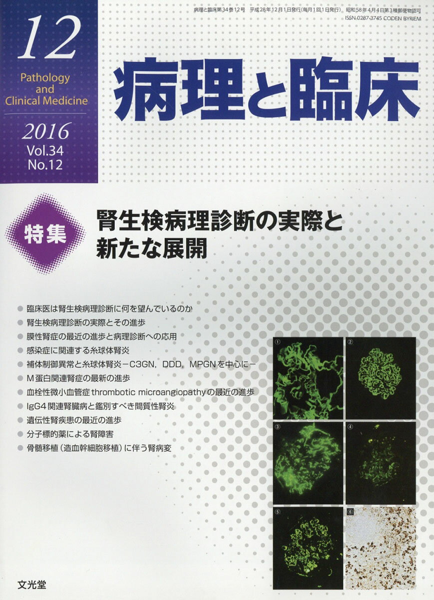 癌の分子病理学 2016年 04 月号 [雑誌]: 病理と臨床 増刊 楽天市場】癌の分子病理学 2016年 04月号 [雑誌]/文光堂 | 価格