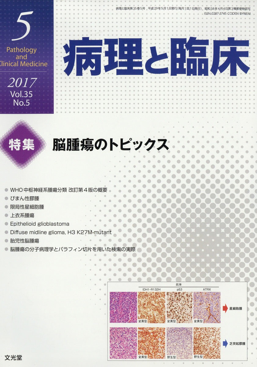 癌の分子病理学 2016年 04 月号 [雑誌]: 病理と臨床 増刊 楽天市場】癌の分子病理学 2016年 04月号 [雑誌]/文光堂 | 価格