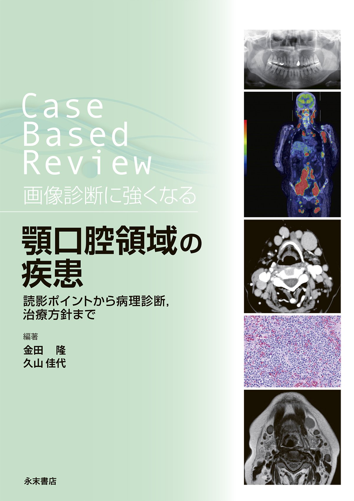 新版 顎関節症はこうして治す すぐできる診断法と治療の実際 新版 顎関節症はこうして治す すぐできる診断法と治療の実際