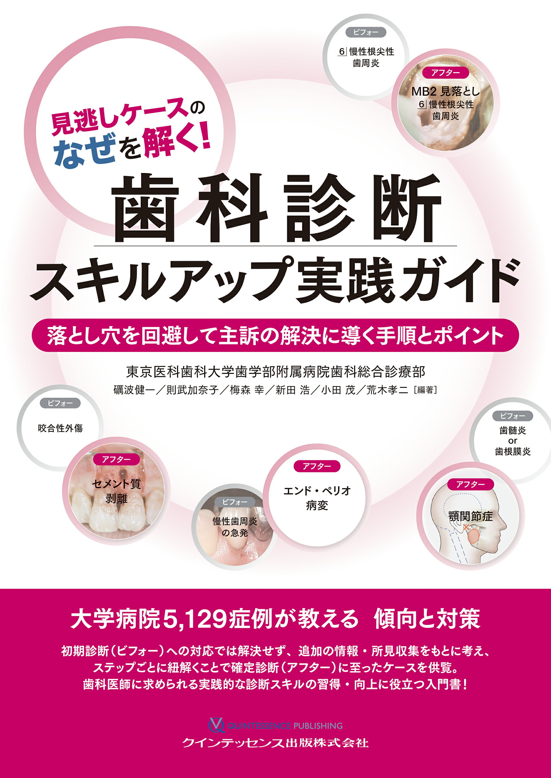 楽天市場】クインテッセンス出版 咬合の岳をゆく！ 高くて険しい咬合を