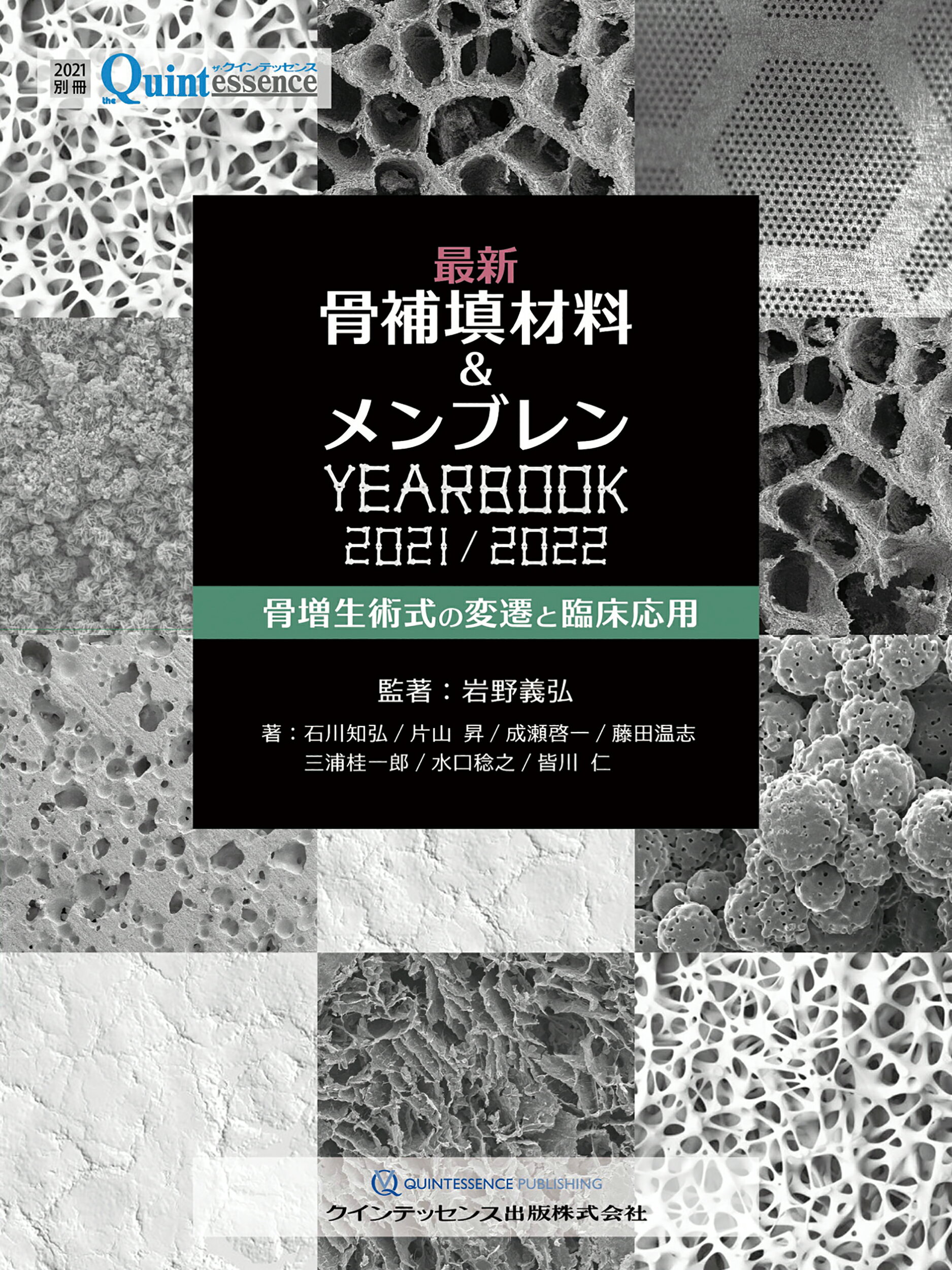 インプラント裏技帖 50 柴原清隆著 書籍詳細「インプラント裏技帖50」 | フォルディネット