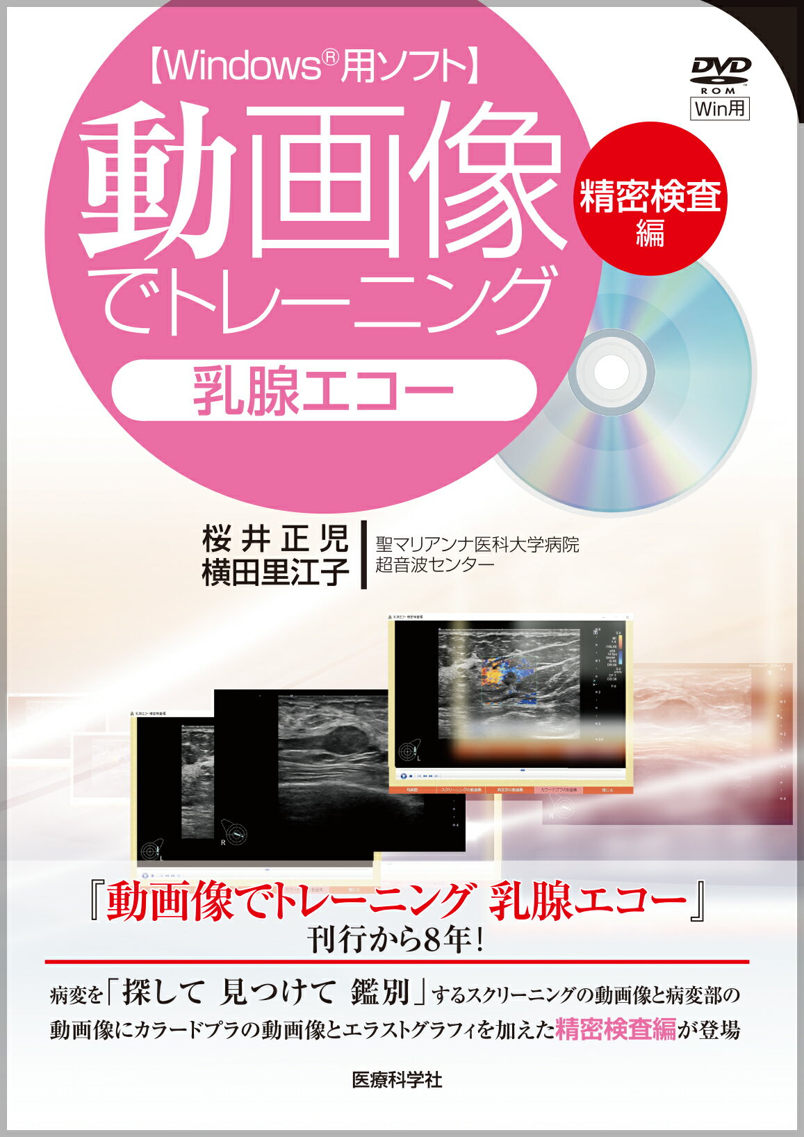 手にとるようにわかる健診のための眼底検査 無散瞳カメラによる撮影と判定 改訂版 手にとるようにわかる健診のための眼底検査 無散瞳カメラによる