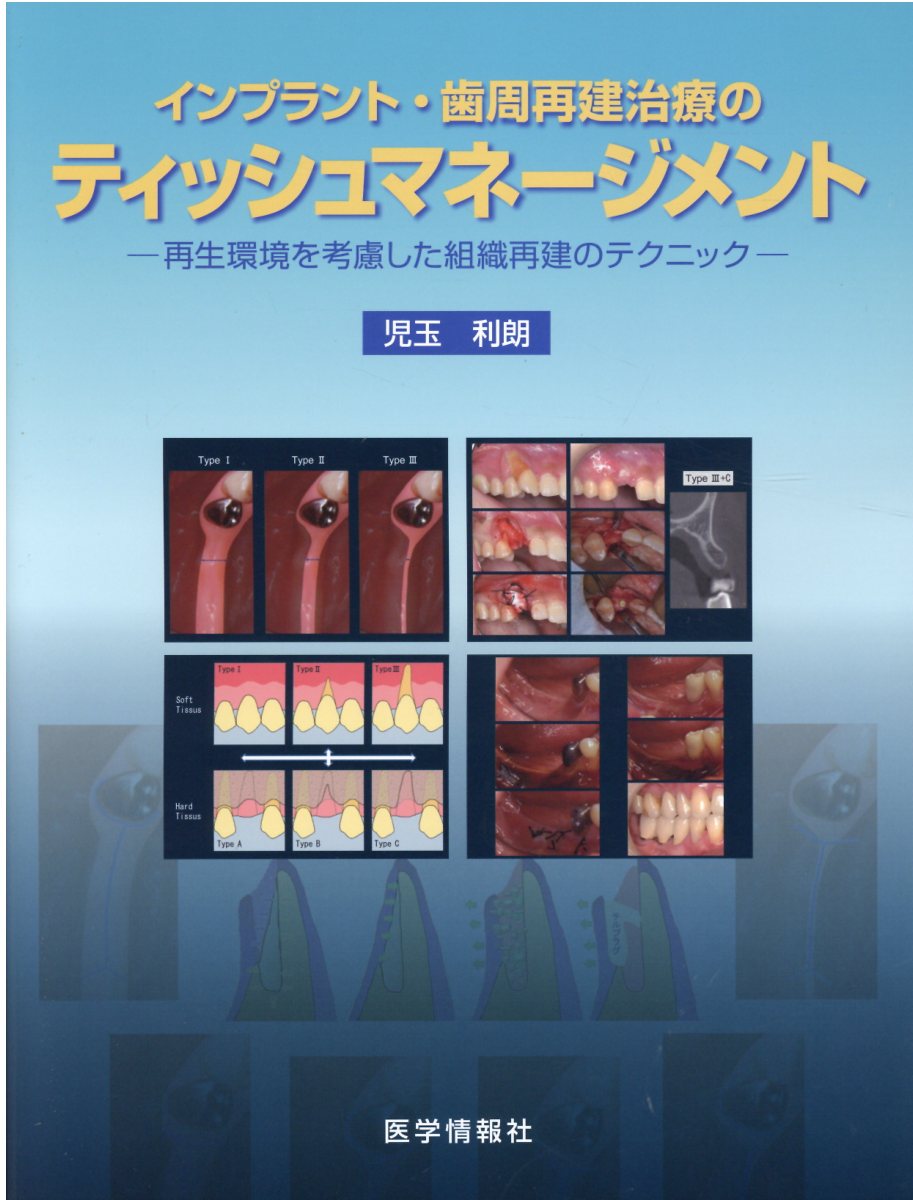 楽天市場】永末書店 埋伏歯の保存治療ストラテジー 誘導・牽引の