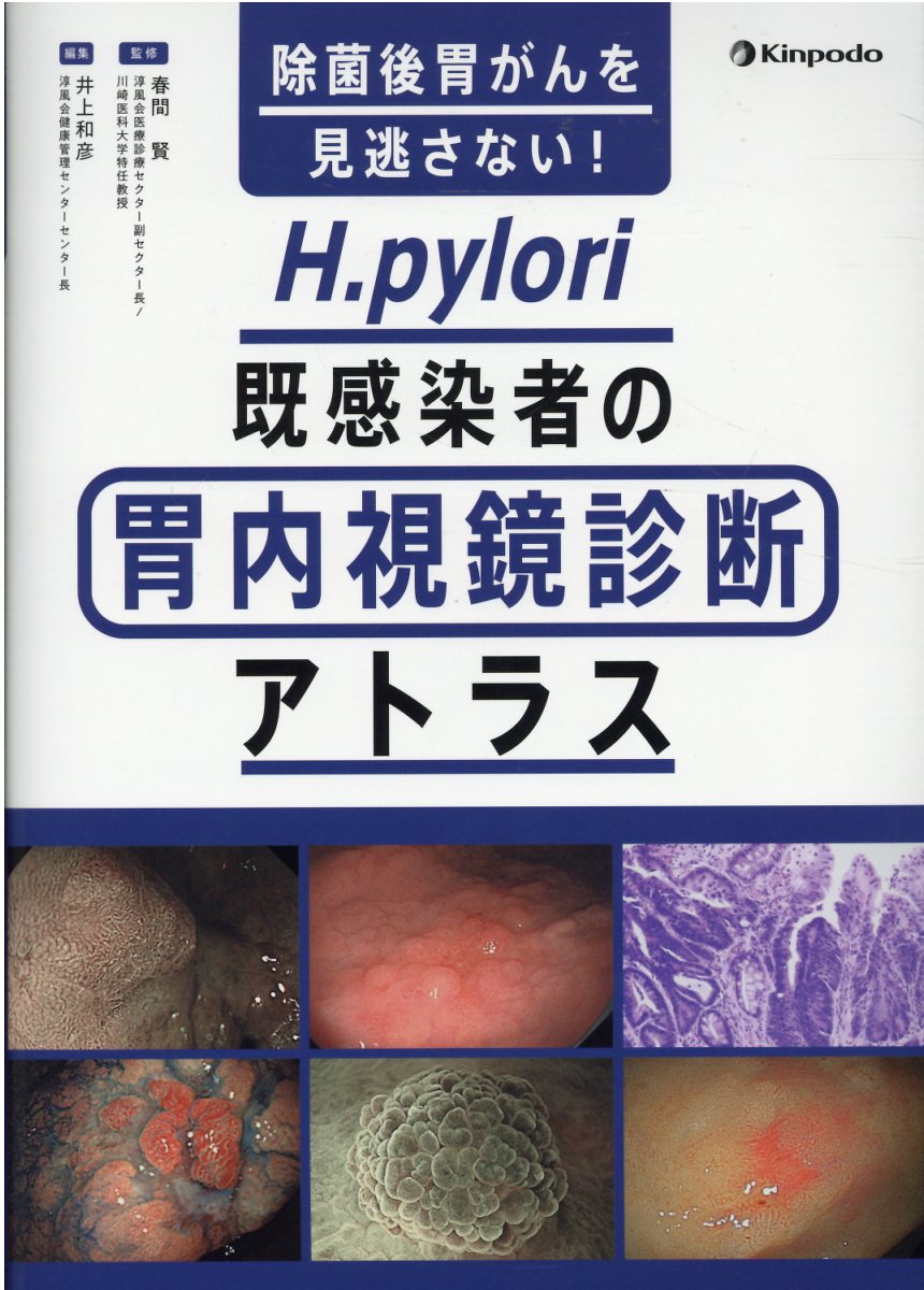 除菌後胃がんを見逃さない！Ｈ．ｐｙｌｏｒｉ既感染者の胃内視鏡診断アトラス/金芳堂/春間賢