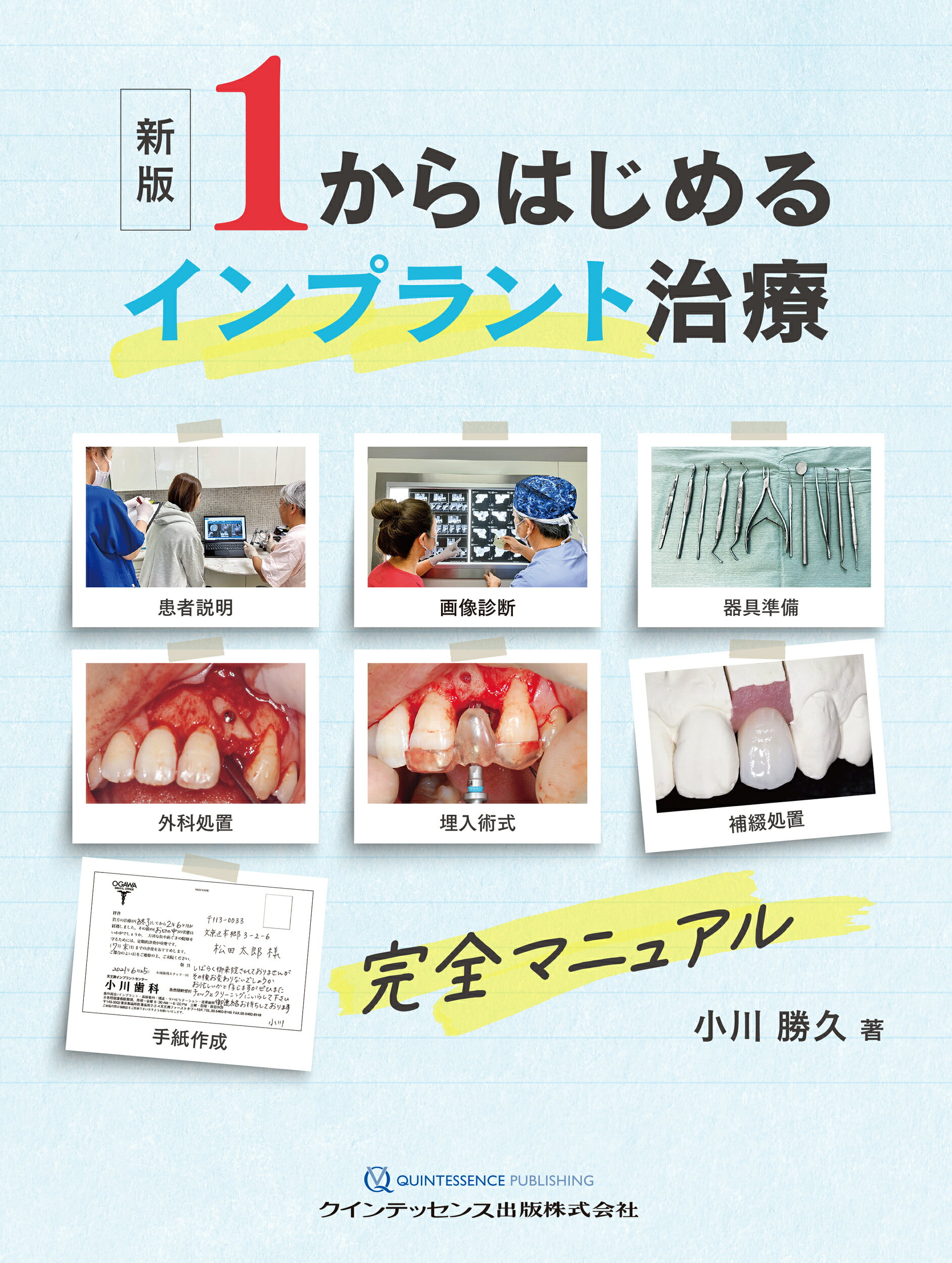 OJのスペシャリストたちがおくる インプラント 基本の「き」 (別冊QDI) OJのスペシャリストたちがおくる インプラント 基本の「き