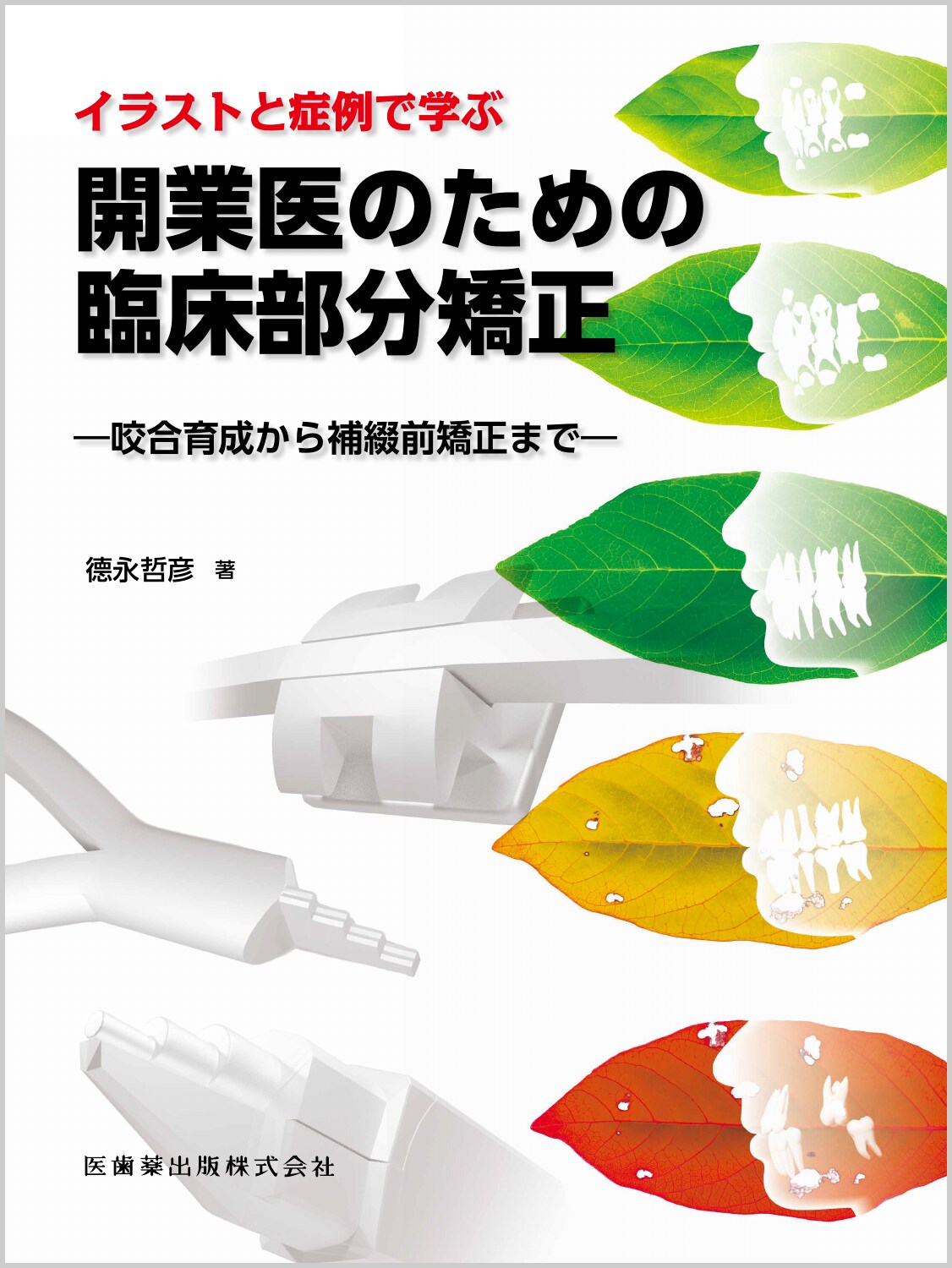診断力を上げる 日常臨床に潜む咬合由来の問題の診断と治療※裁断済 診断力を上げる 日常臨床に潜む咬合由来の問題の診断と治療の