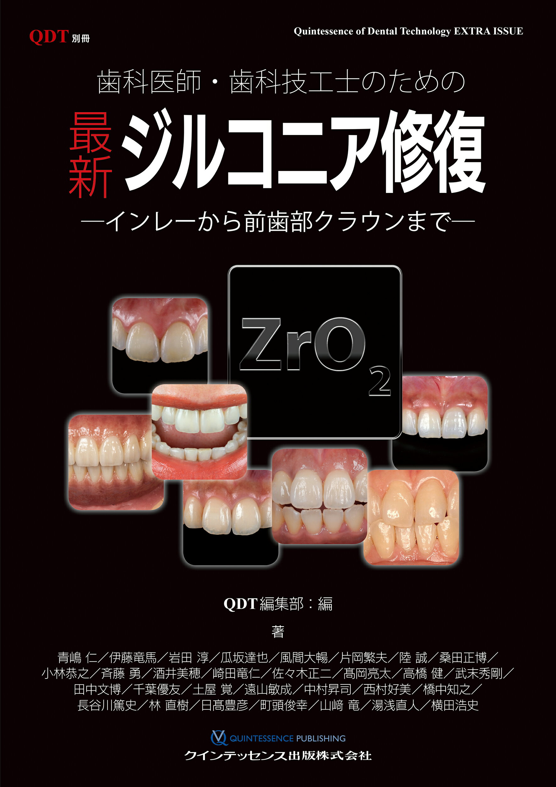 楽天市場】デンタルダイヤモンド社 インプラント裏技帖50/デンタル