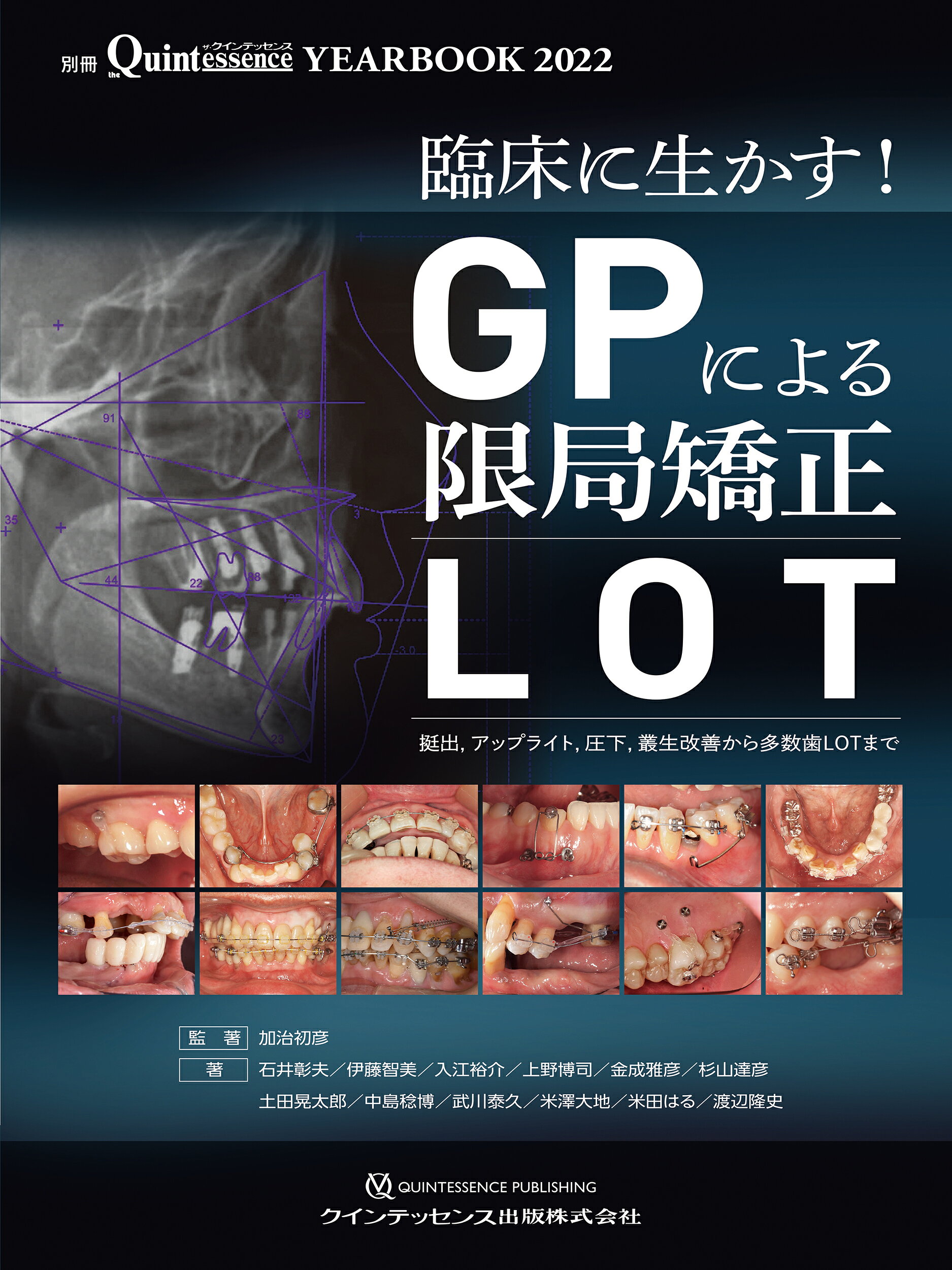 臨床に生かす！ＧＰによる限局矯正［ＬＯＴ］ 挺出，アップライト，圧下，叢生改善から多数歯ＬＯＴ/クインテッセンス出版/加治初彦
