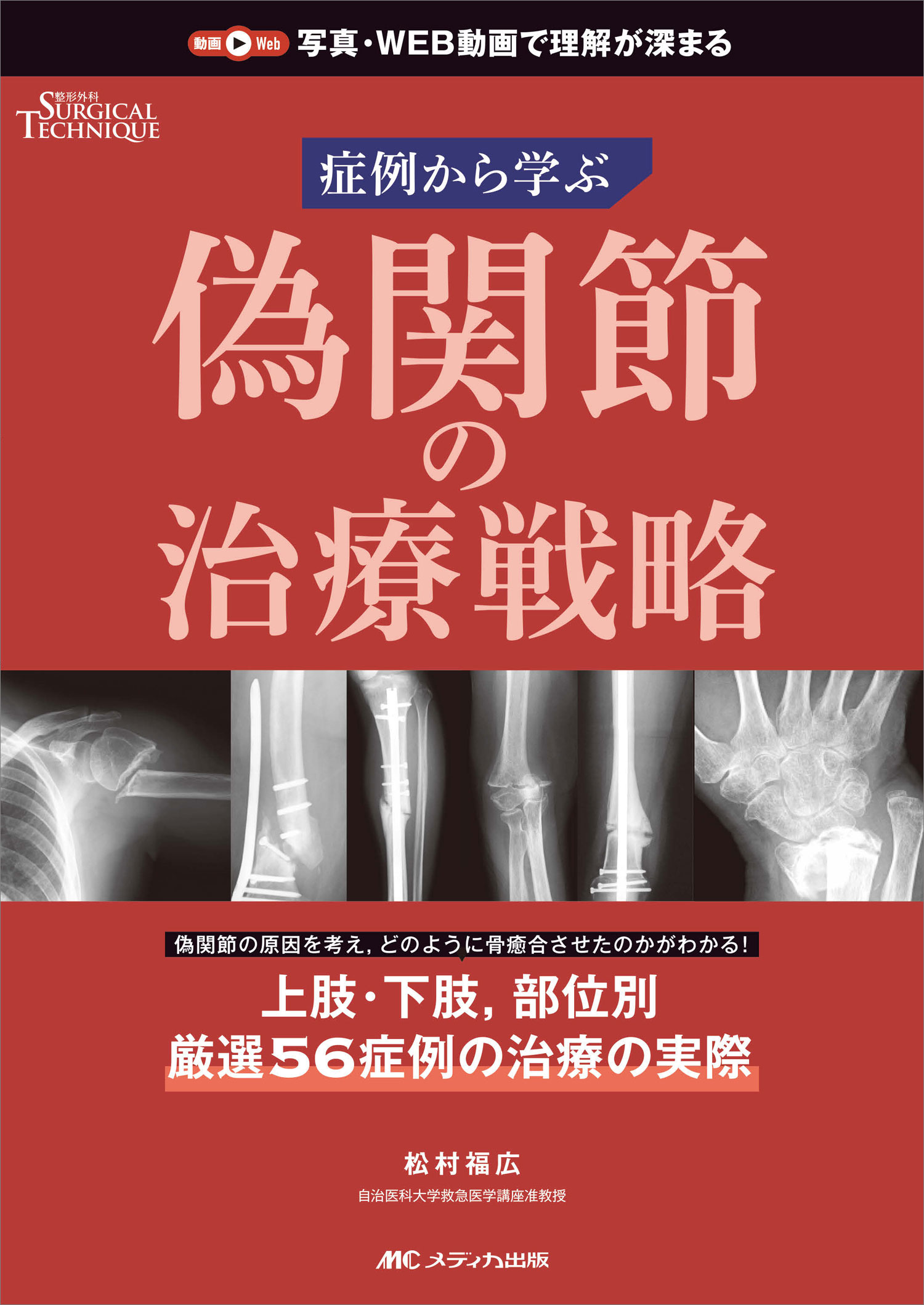 肘の外傷 : 診断・手術・保存療法 肘の外傷:診断・手術・保存療法 (整形外科SURGICAL TECHNIQUE