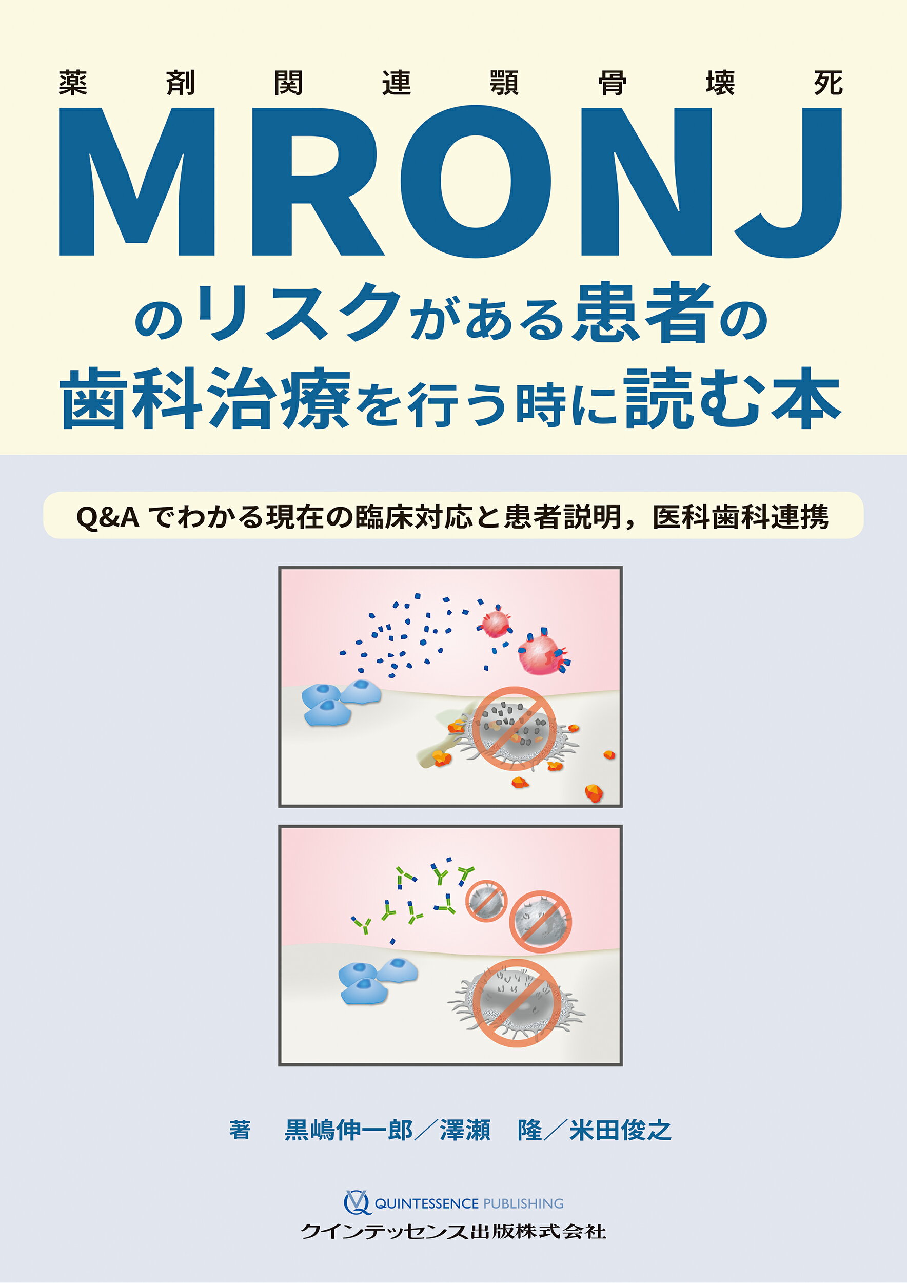 楽天市場】クインテッセンス出版 超速でわかる象牙質知覚過敏