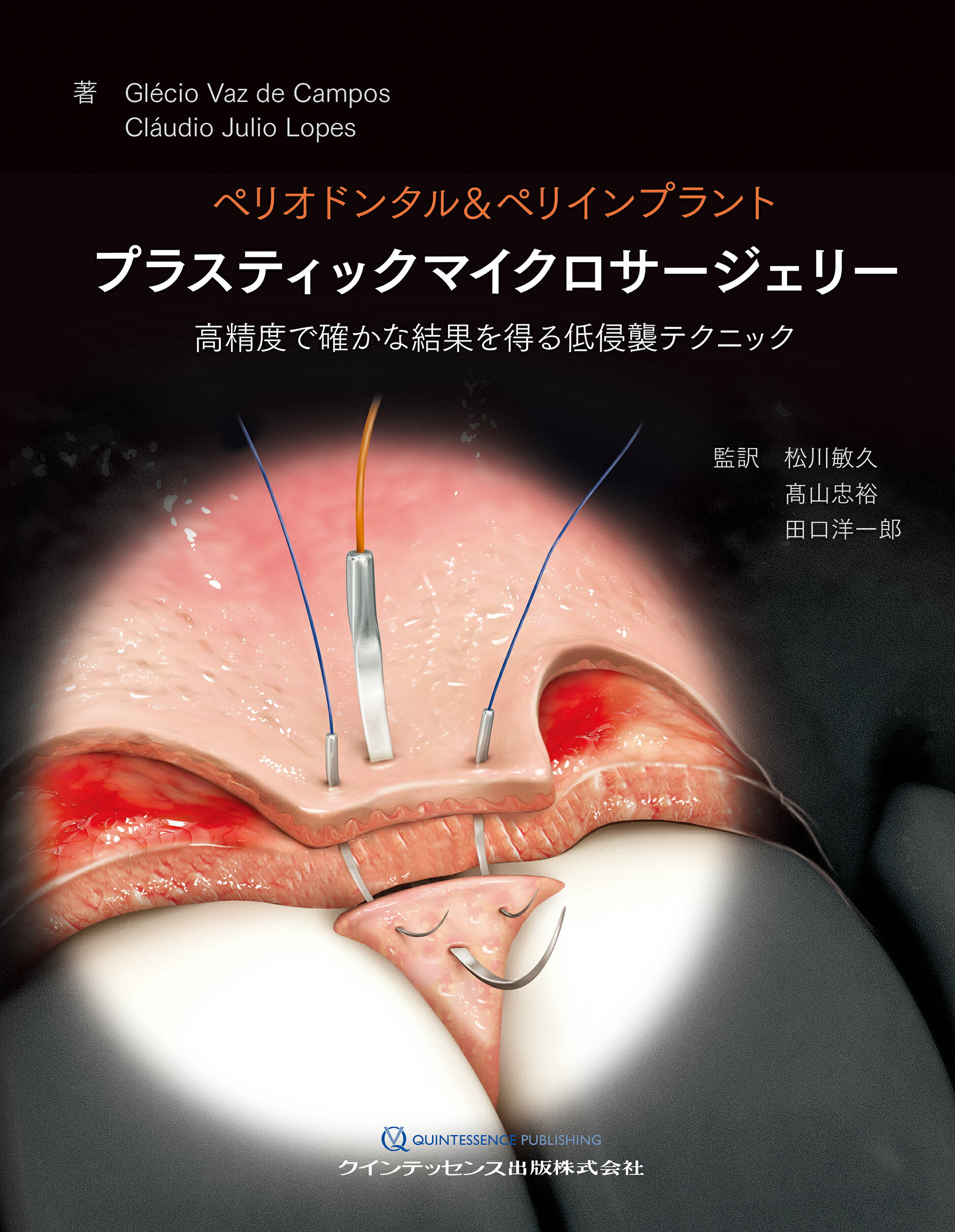 楽天市場】デンタルダイヤモンド社 低侵襲・低コスト・省時間を実現
