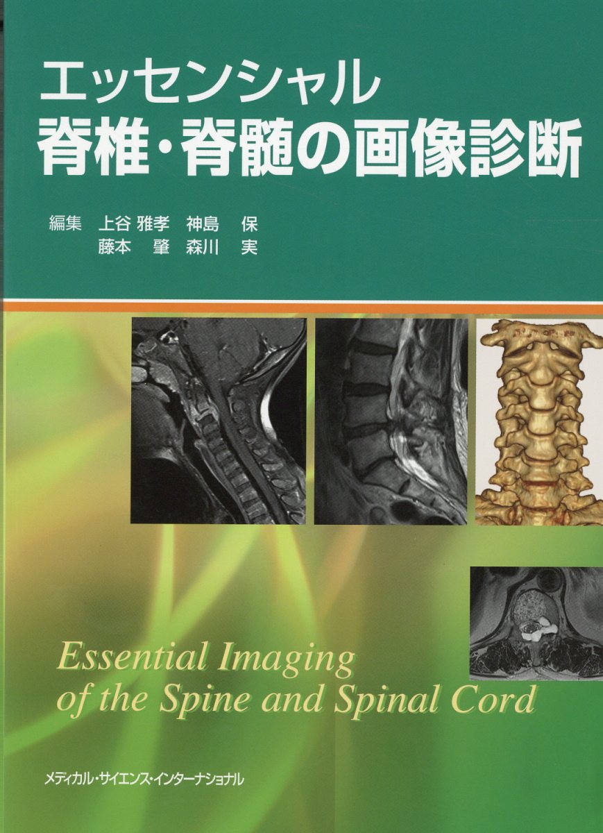 エッセンシャル脊椎・脊髄の画像診断/メディカル・サイエンス・インタ-ナショナ/上谷雅孝