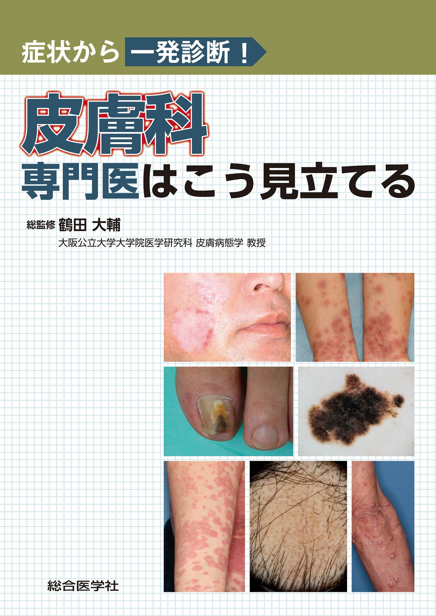 【裁断済】皮膚科　膠原病　皮疹から全身を診る Amazon.com: 皮膚科 膠原病ー皮疹から全身を診る (皮膚科ベスト