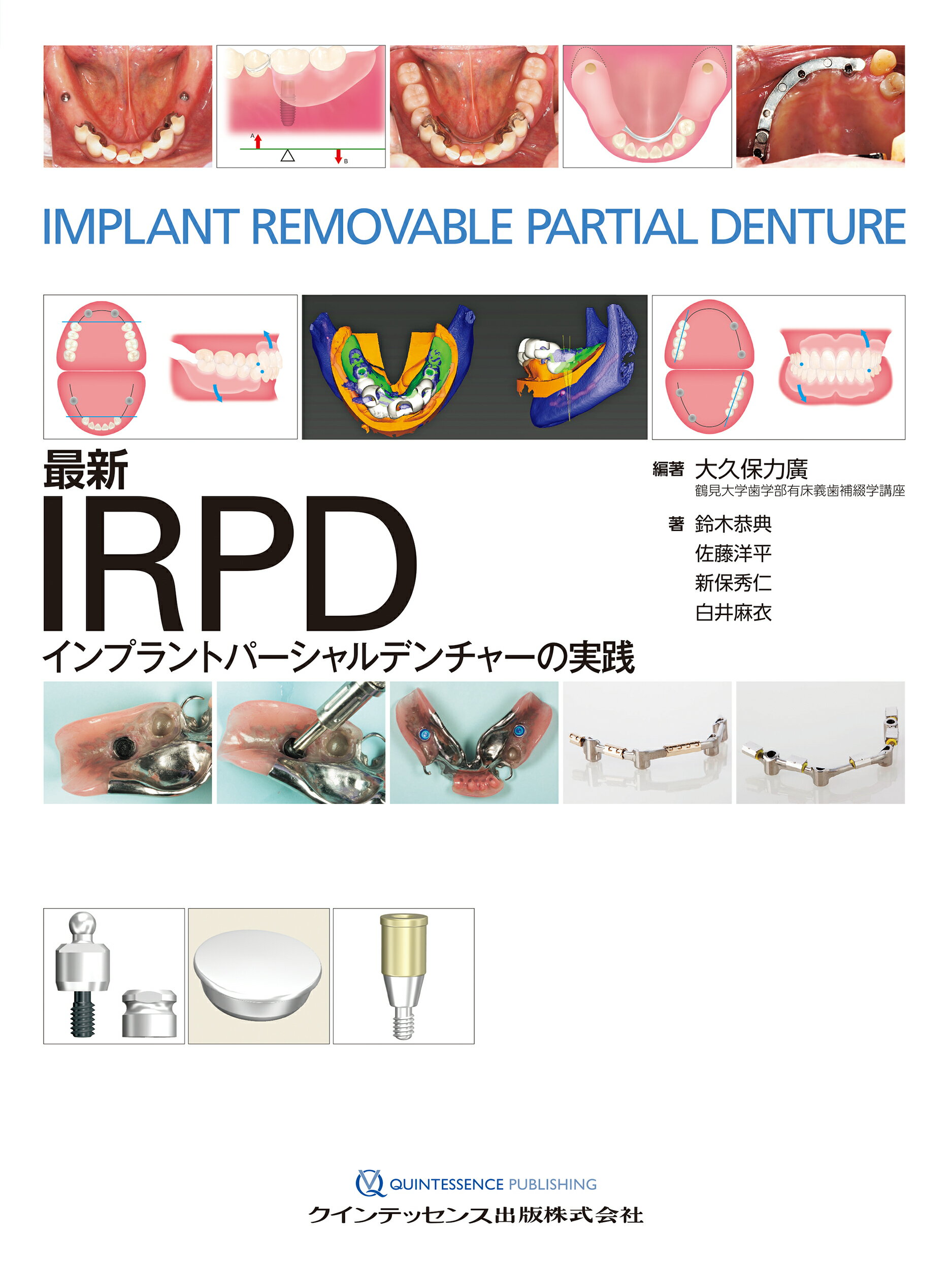 最新ＩＲＰＤ　インプラントパーシャルデンチャーの実践/クインテッセンス出版/大久保力廣