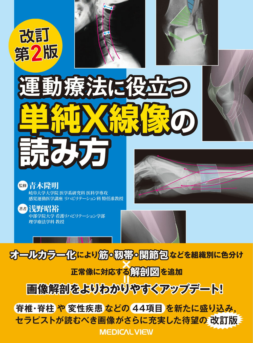 肩関節のMRI 第3版　: 読影ポイントと新しい知見 楽天市場】メジカルビュー社 肩関節のMRI 読影ポイントと