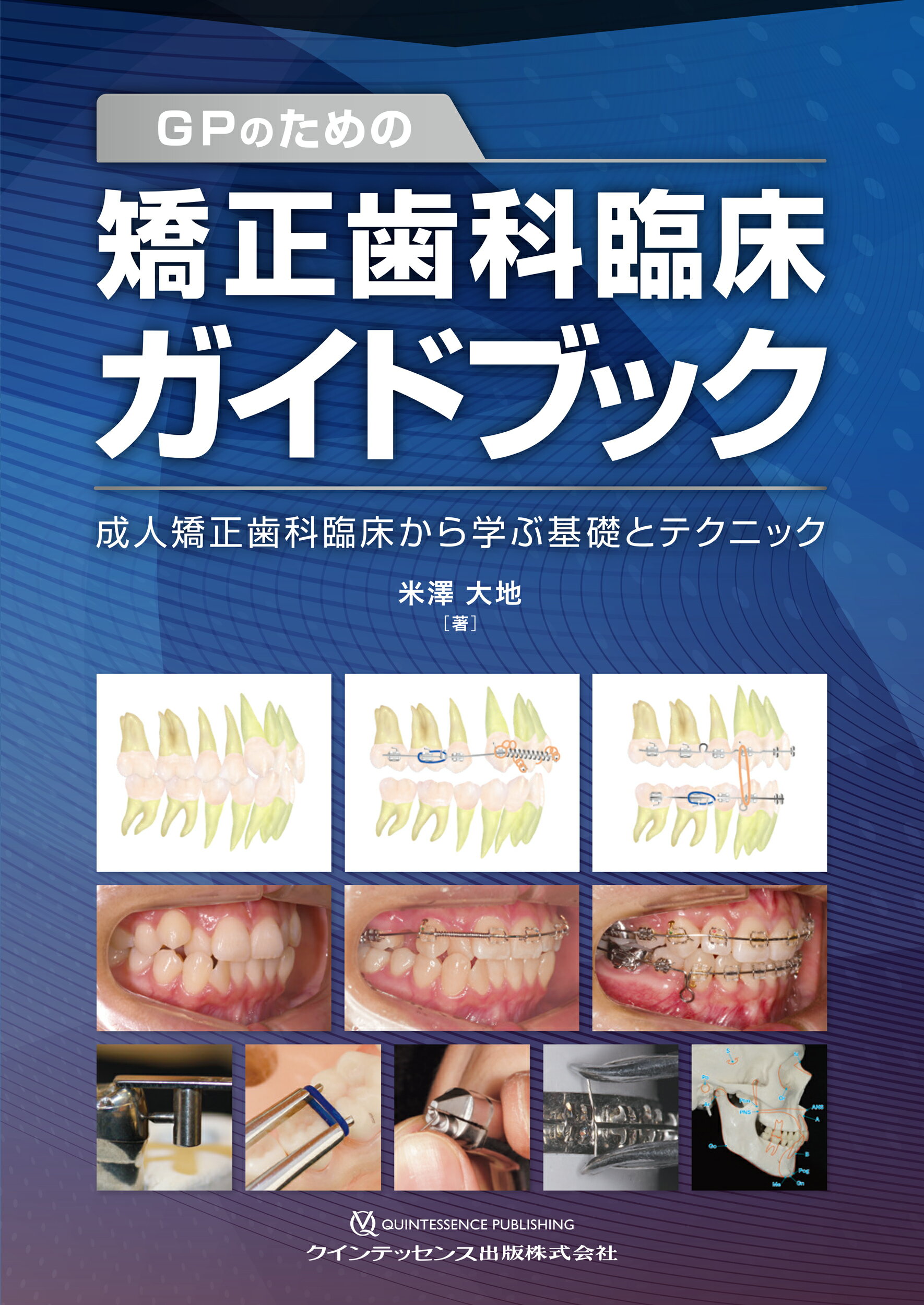 【裁断済み】生体にやさしい戦略的矯正歯科治療 生体にやさしい戦略的矯正歯科治療と歯科矯正用アンカー