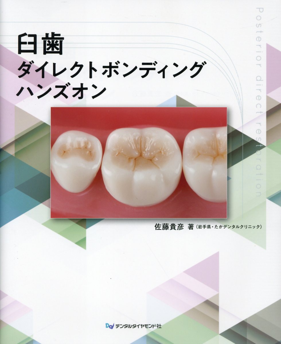 臼歯ダイレクトボンディング　ハンズオン/デンタルダイヤモンド社/佐藤貴彦