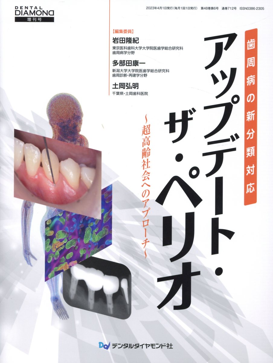 歯周病の新分類対応　アップデート・ザ・ペリオ 歯周病の新分類対応/デンタルダイヤモンド社/岩田隆紀