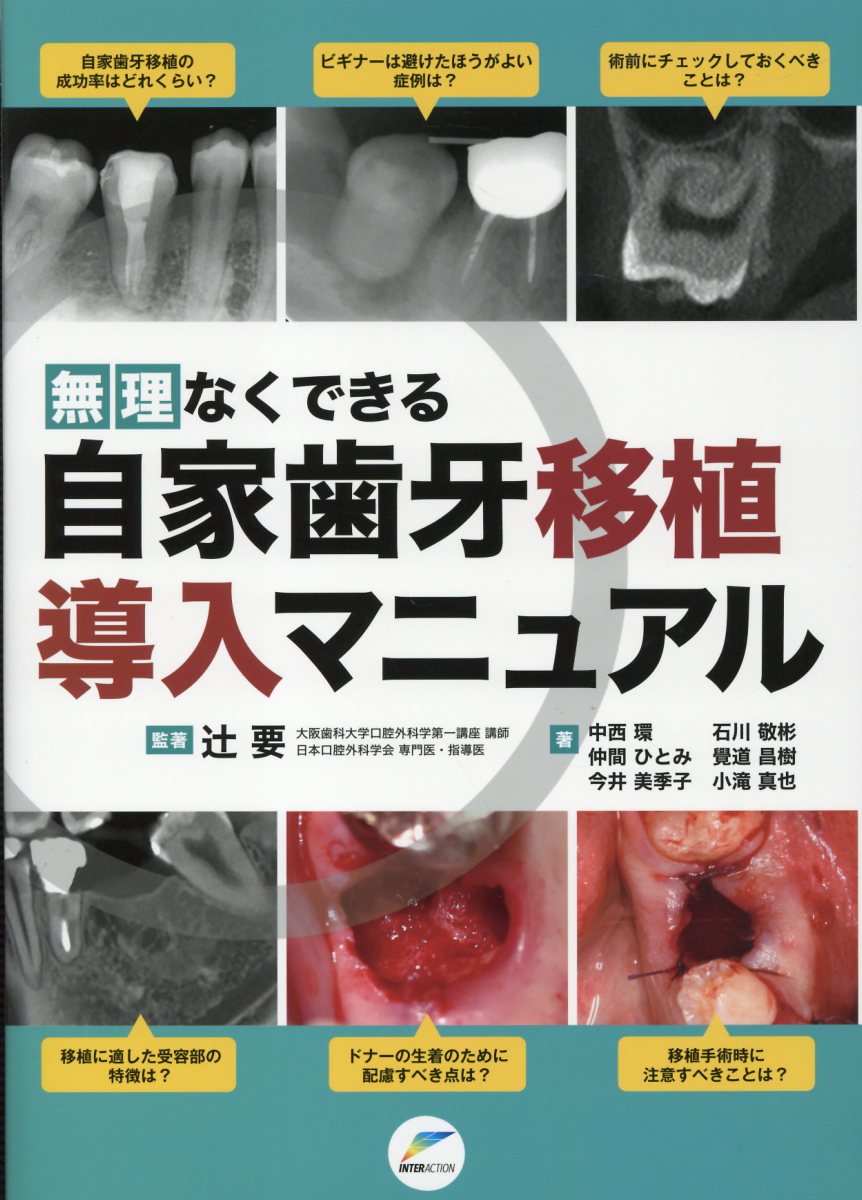 無理なくできる自家歯牙移植導入マニュアル/インタ-アクション/辻要
